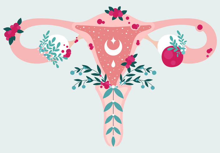 endometriose illustratie