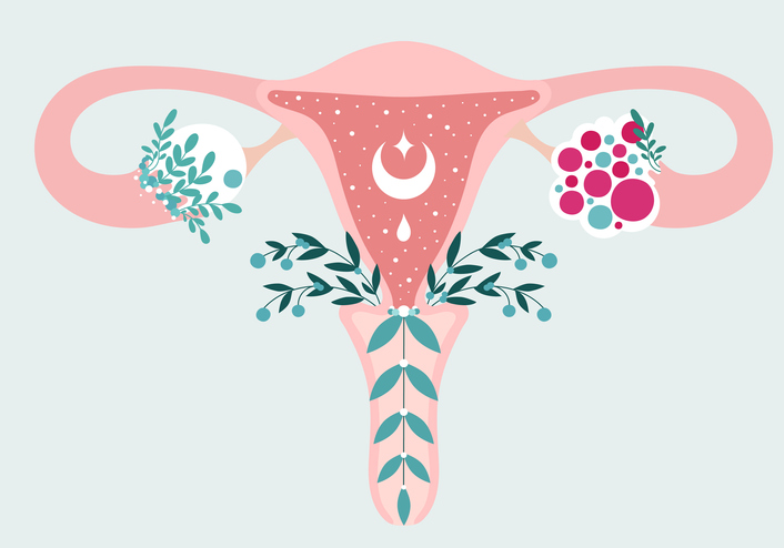 pcos bloemige afbeelding baarmoeder
